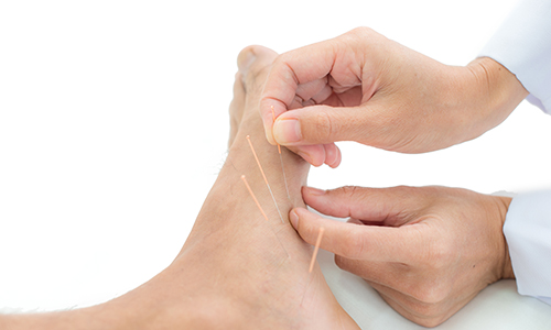 Innovative Approaches to Treating Achilles Tendinitis